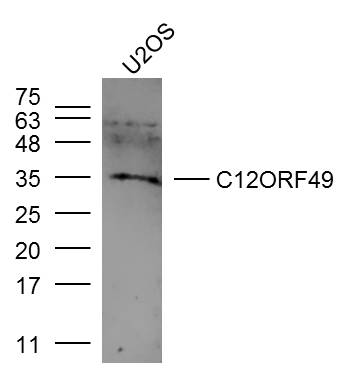 1 - C12ORF49 Rabbit pAb AP59437