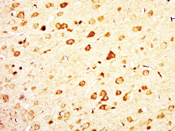 14 - C12ORF68 Rabbit pAb AP59442