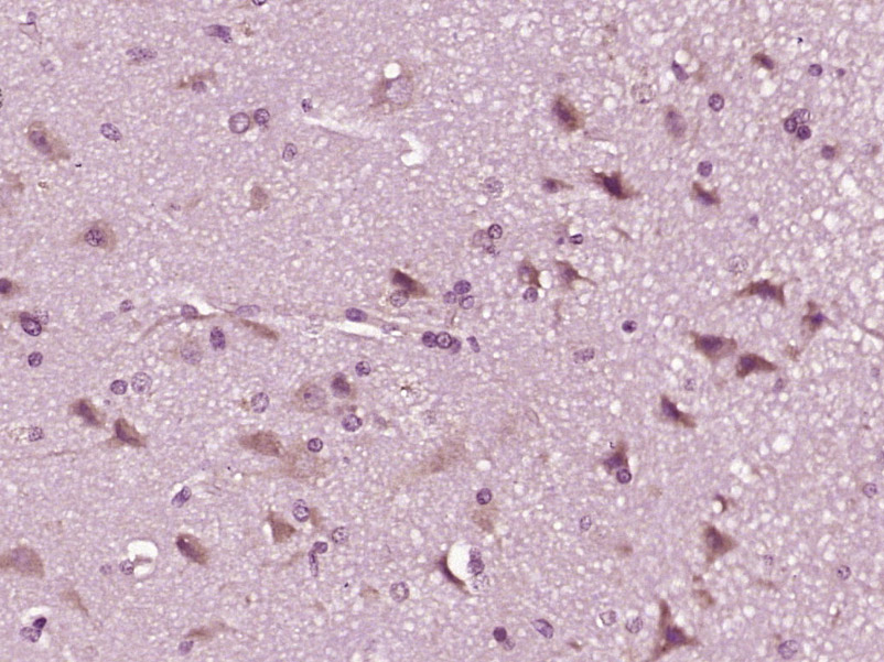 14 - CWH43 Rabbit pAb AP59445