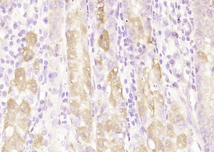 14 - C21orf70 Rabbit pAb AP59452