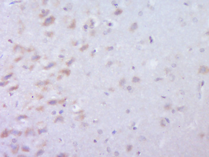 14 - C22orf25 Rabbit pAb AP59454