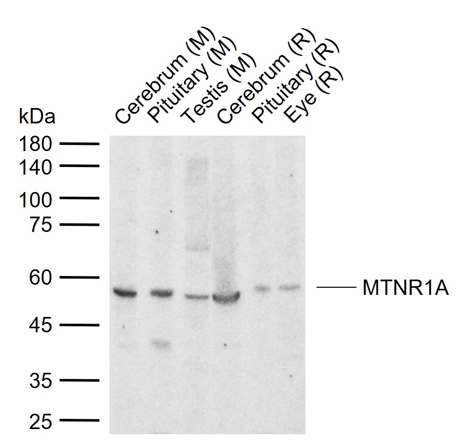 1 - MTNR1A Rabbit pAb AP93918