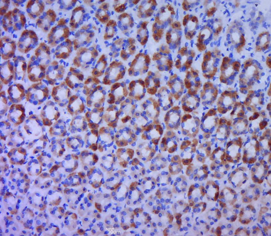 14 - BTG1 Rabbit pAb AP93920