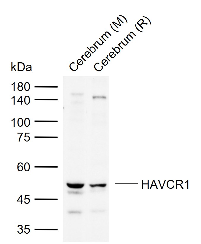 1 - HAVCR1 Rabbit pAb AP93922