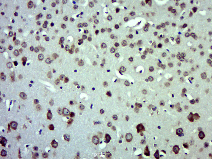 14 - CXCL11 Rabbit pAb AP93930