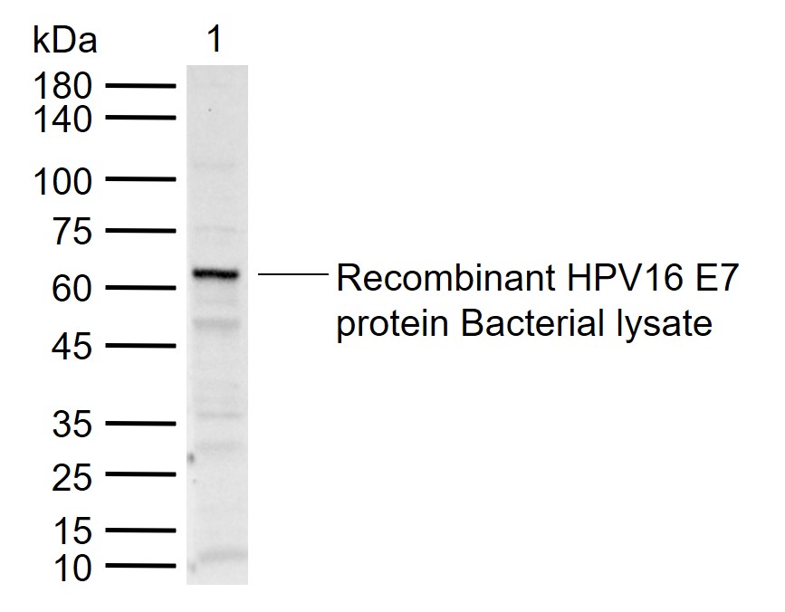 1 - HPV16 E7 Rabbit pAb AP93933