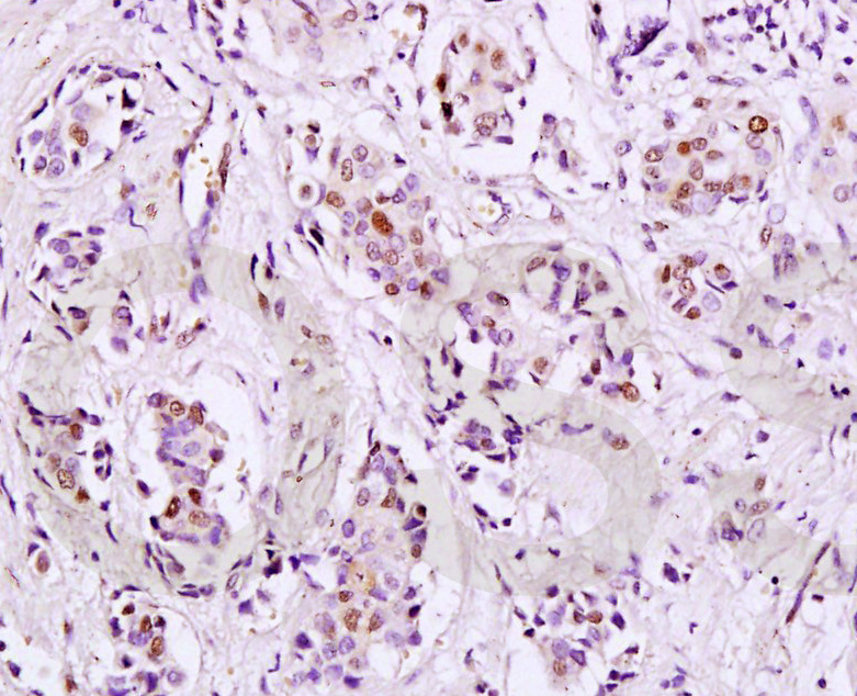 14 - HPV16 E7 Rabbit pAb AP93933