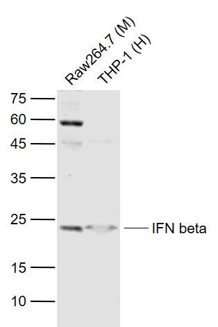1 - IFNB1 Rabbit pAb AP93934