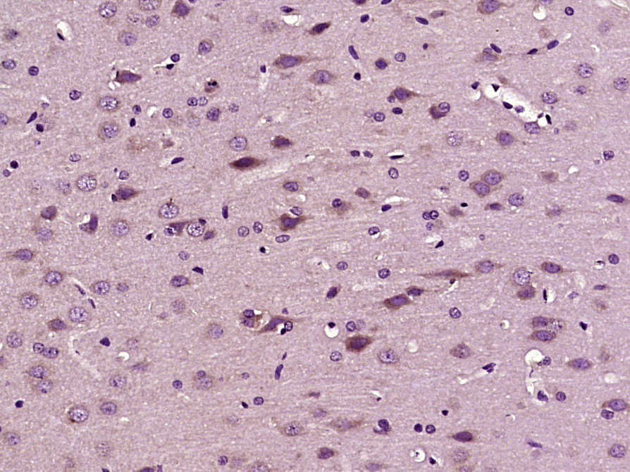 14 - IRS3 Rabbit pAb AP93940