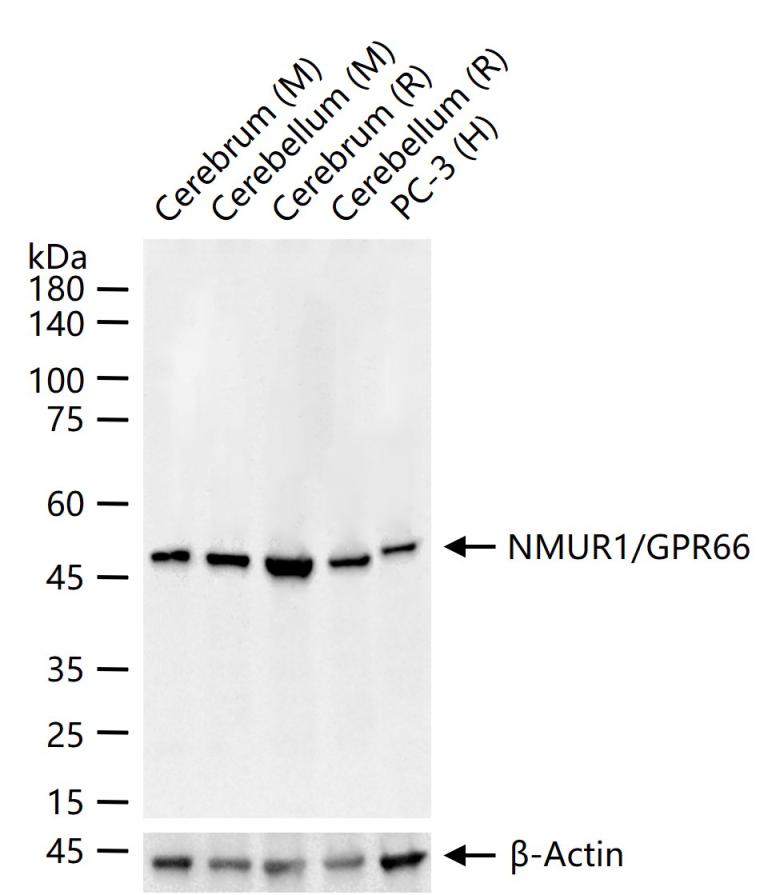 1 - NMUR1/GPR66 Rabbit pAb AP93943