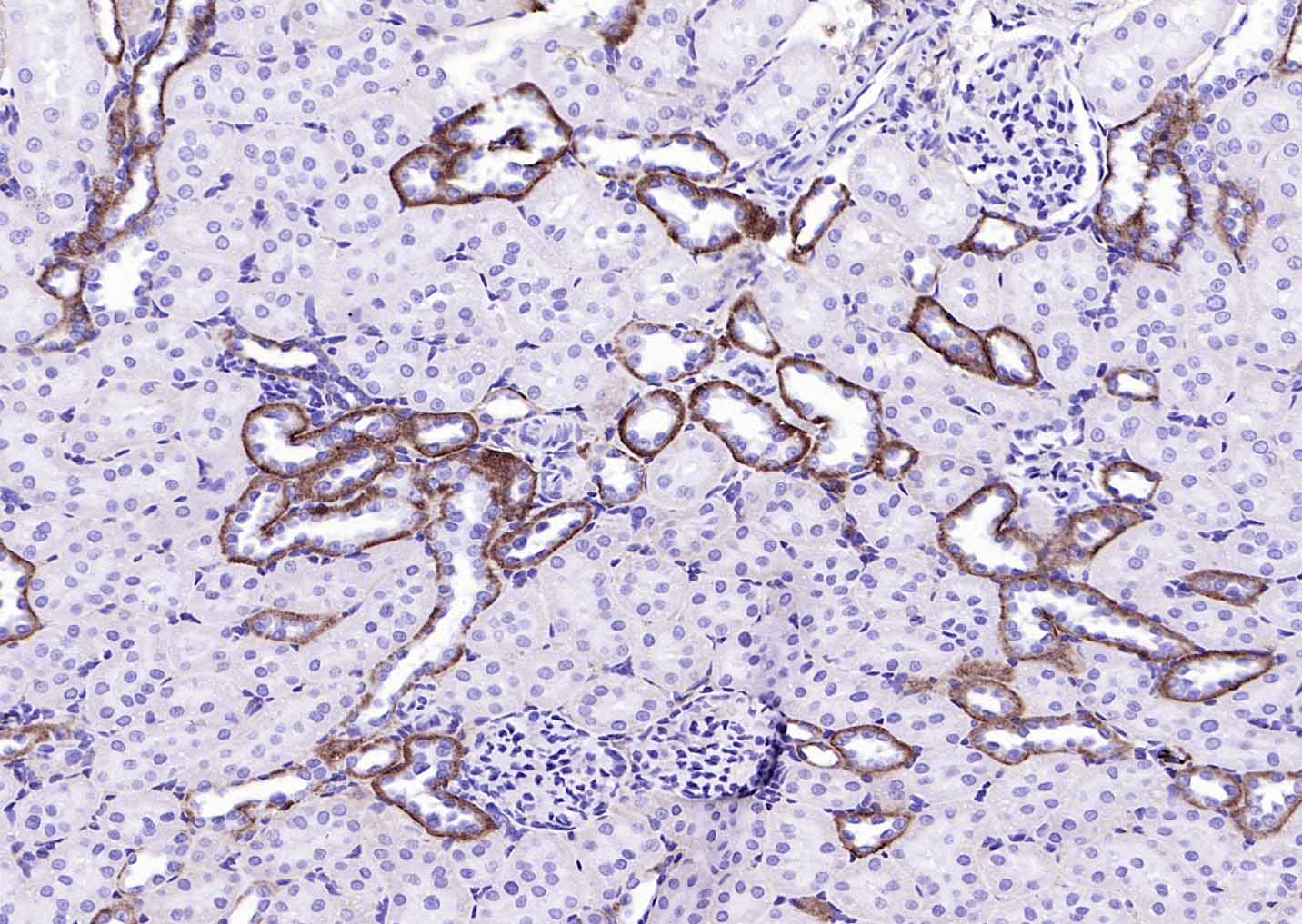 14 - EMP-1 Rabbit pAb AP93944