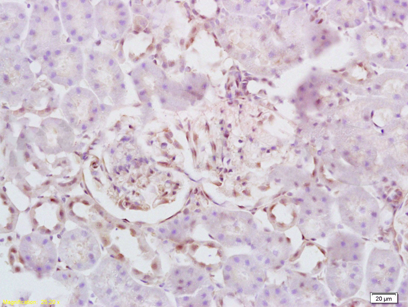 14 - Defensin beta 2 Rabbit pAb AP93946