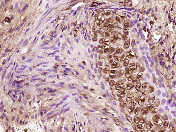 14 - CCL26 Rabbit pAb AP93948