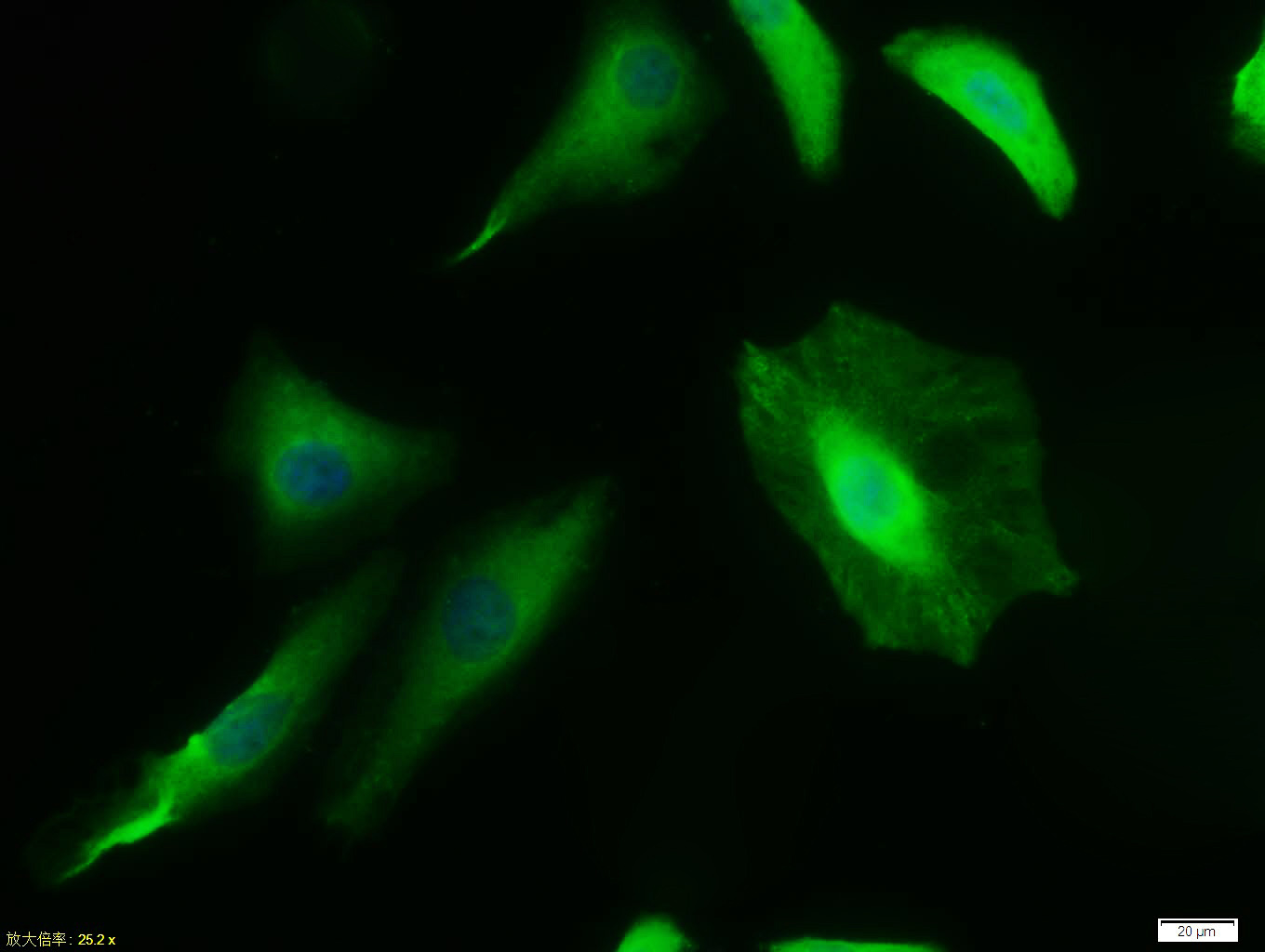 0 - DR5 Rabbit pAb AP93949