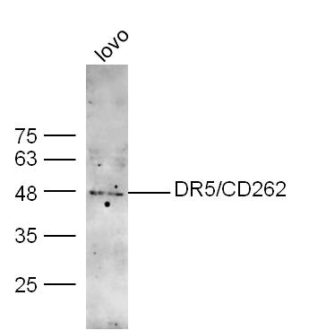 1 - DR5 Rabbit pAb AP93949