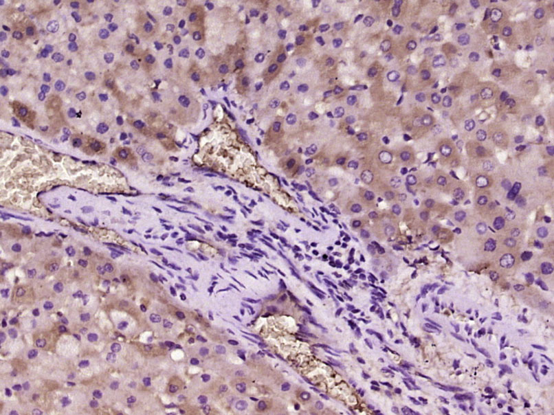 14 - ox-LDL Rabbit pAb AP93950