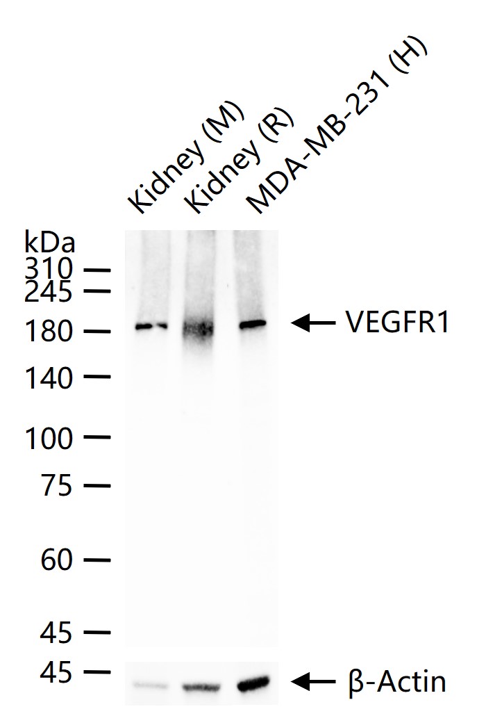 1 - VEGFR1 Rabbit pAb AP93953