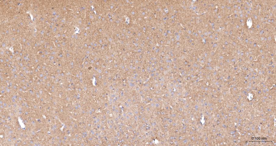 14 - VEGFR1 Rabbit pAb AP93953