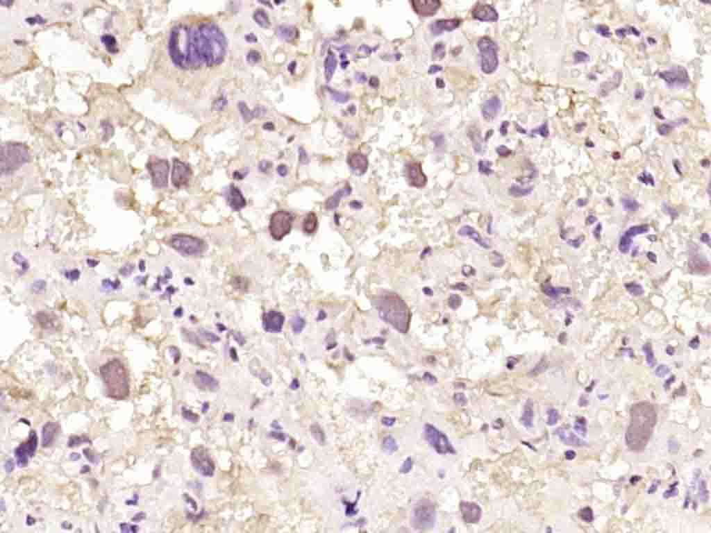 14 - NUP88 Rabbit pAb AP93955