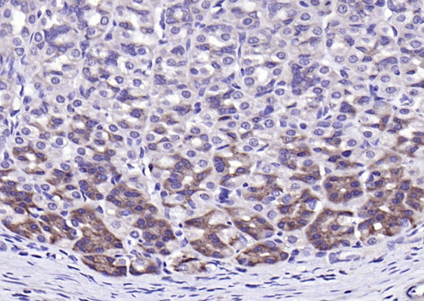 14 - NQO1 Rabbit pAb AP93956