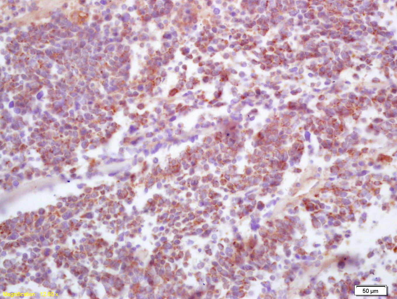 14 - HPV16 E7 Rabbit pAb AP93959