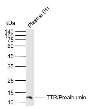 1 - TTR/Prealbumin Mouse mAb AP93961