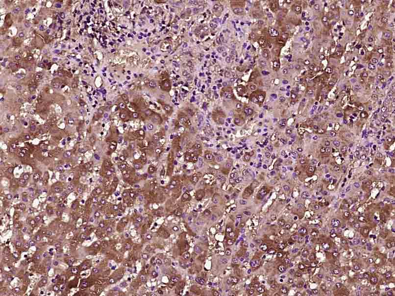 14 - TTR/Prealbumin Mouse mAb AP93961