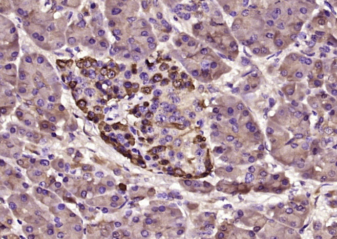 14 - TTR/Prealbumin Mouse mAb AP93962