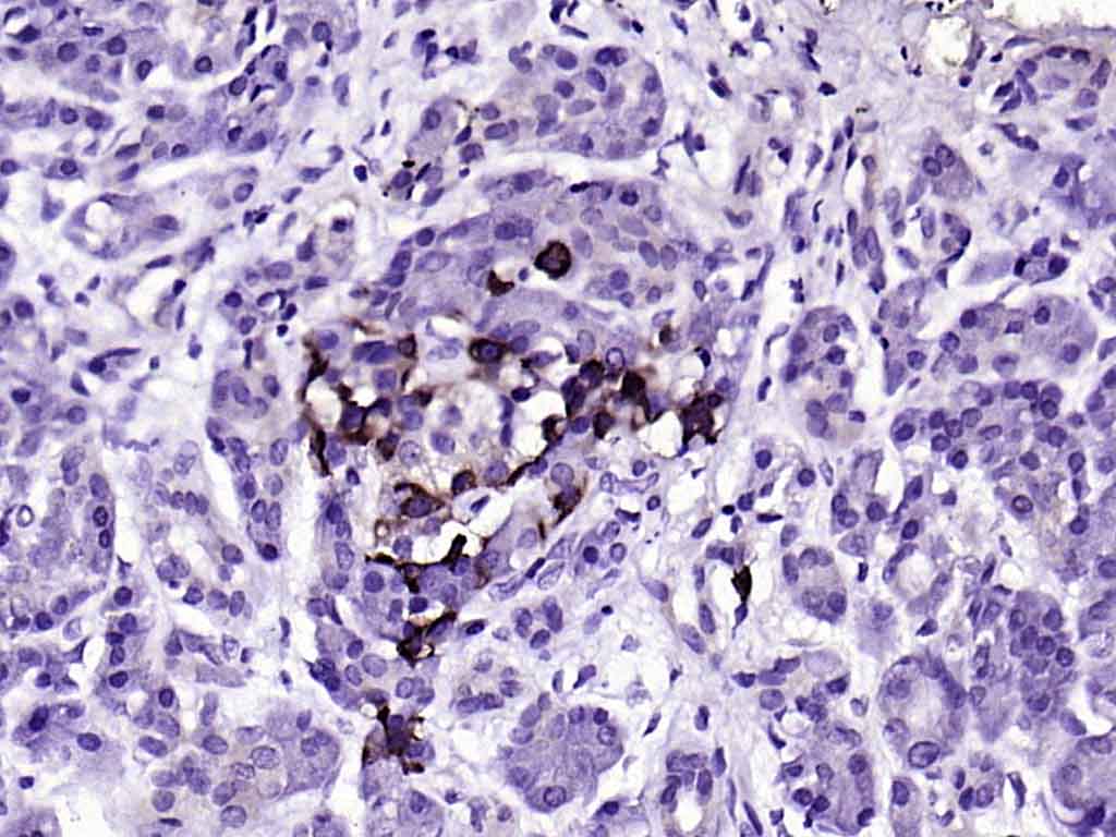 14 - TTR/Prealbumin Mouse mAb AP93963