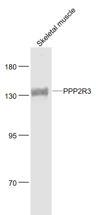 1 - PPP2R3 Rabbit pAb AP93964