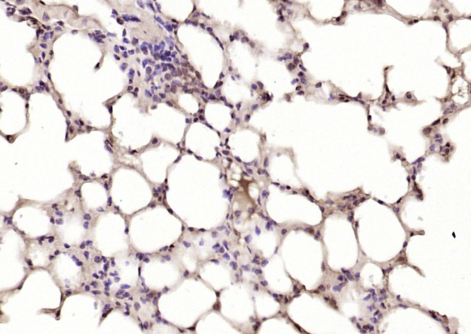 14 - PPP2R3 Rabbit pAb AP93964