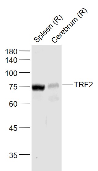 1 - TRF2 Rabbit pAb AP93965