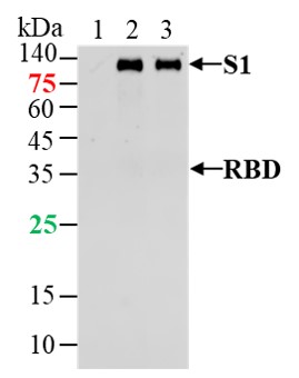 1 - SARS-CoV-2 (2019-nCoV) Spike S1 Mouse mAb AP93968