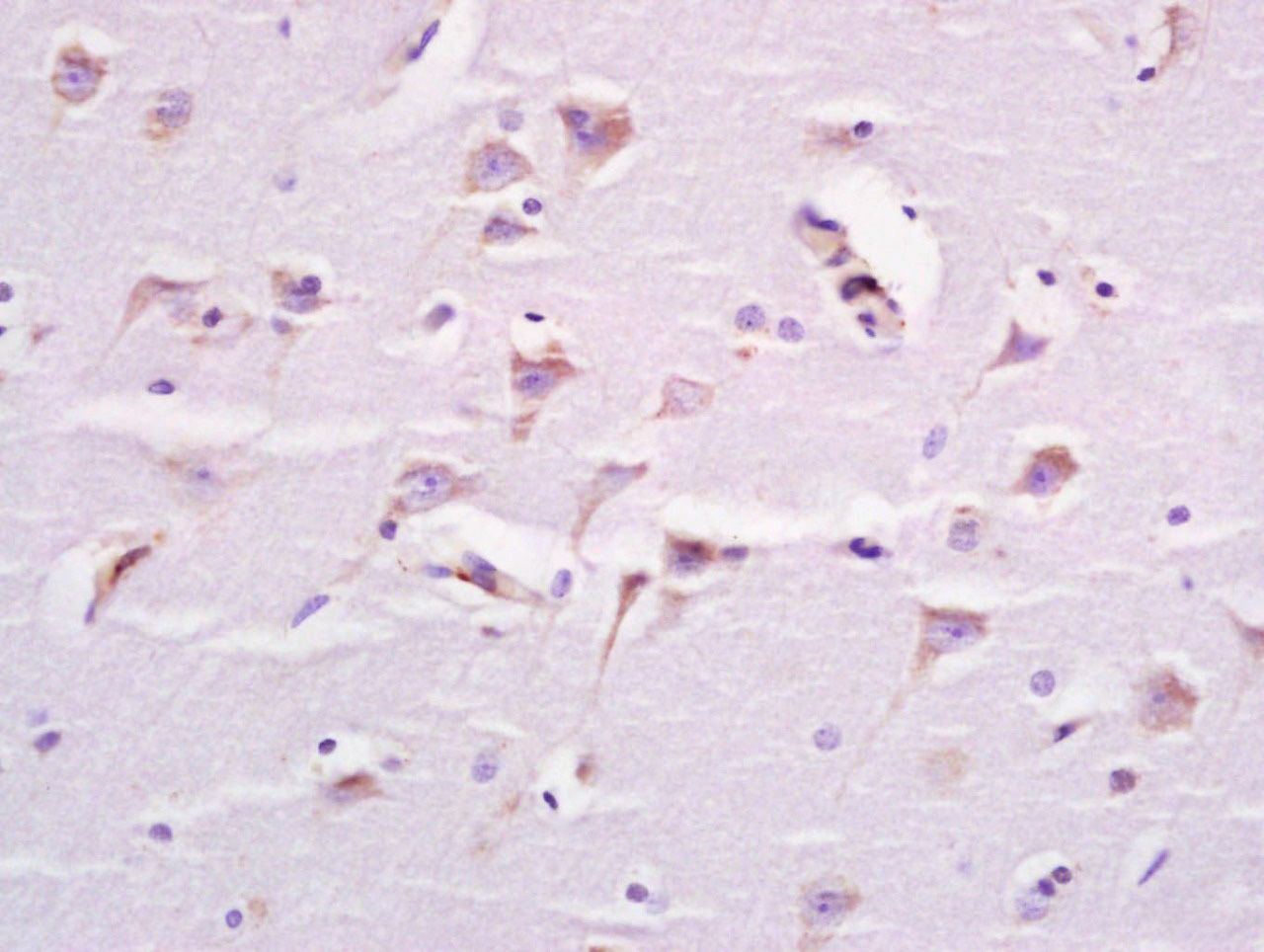 14 - Neuronal thread protein AD7c-NTP Rabbit pAb AP93969