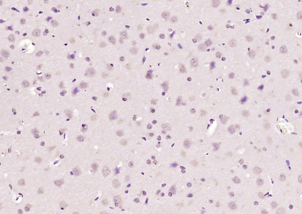 14 - GNRH/LHRH Rabbit pAb AP93970