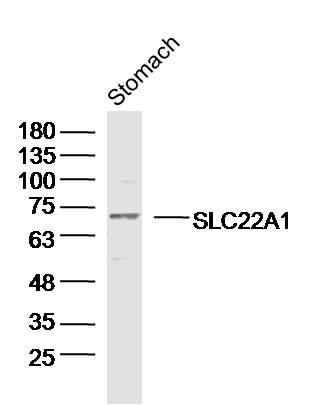 1 - SLC22A1 Rabbit pAb AP93971