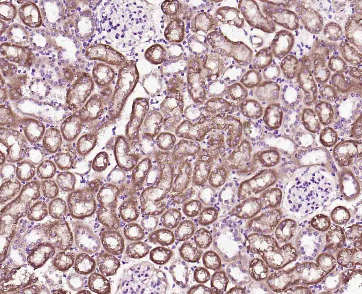 14 - ECM1 Rabbit pAb AP93972