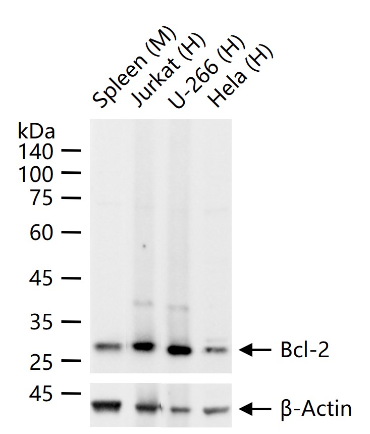 1 - Apoptosis Research Antibody Assembly kit(bcl-2, bax, Caspase-3, Caspase-9, Cytochrome C) AP93977