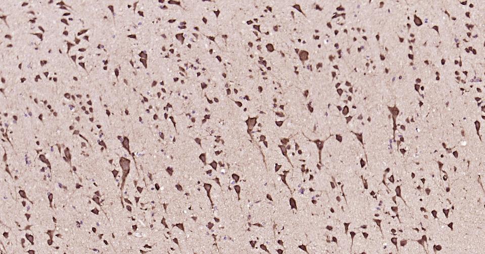 14 - Apoptosis Research Antibody Assembly kit(bcl-2, bax, Caspase-3, Caspase-9, Cytochrome C) AP93977