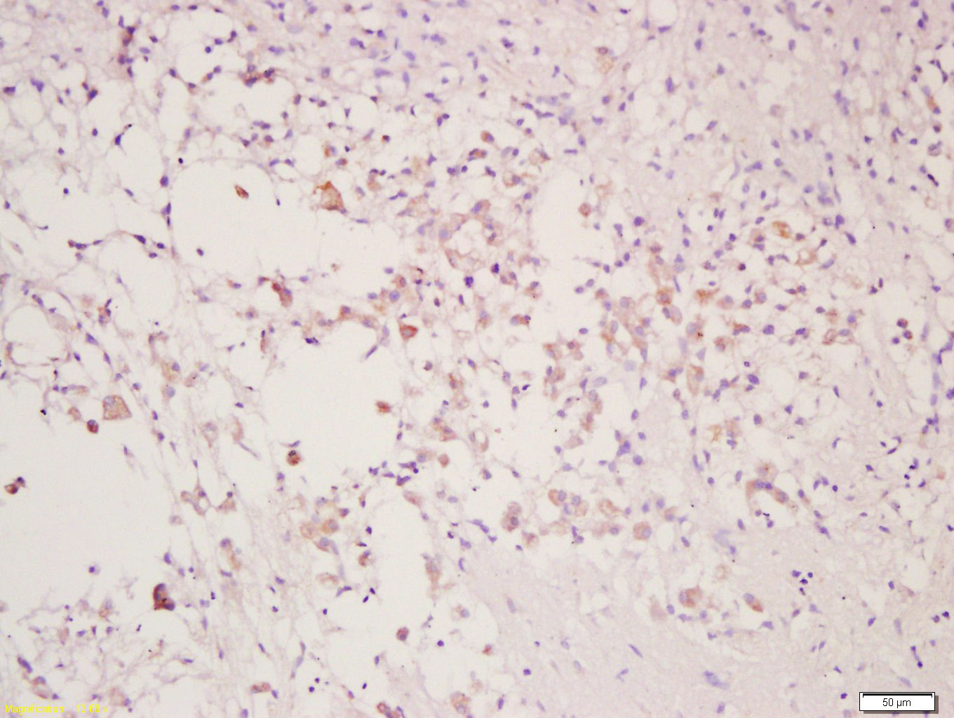 14 - CLEC9A Rabbit pAb AP93979