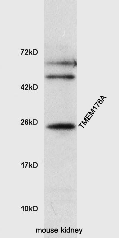 1 - TMEM176A Rabbit pAb AP93980