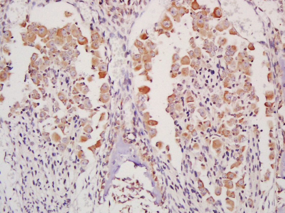 14 - TMEM176A Rabbit pAb AP93980