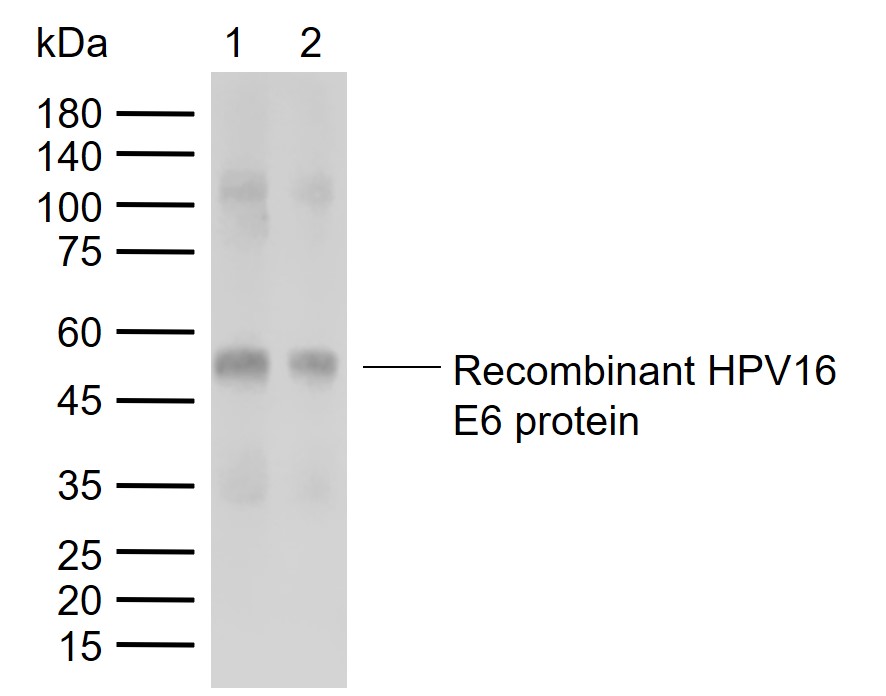 1 - HPV16 E6 + HPV18 E6 Rabbit pAb AP93982