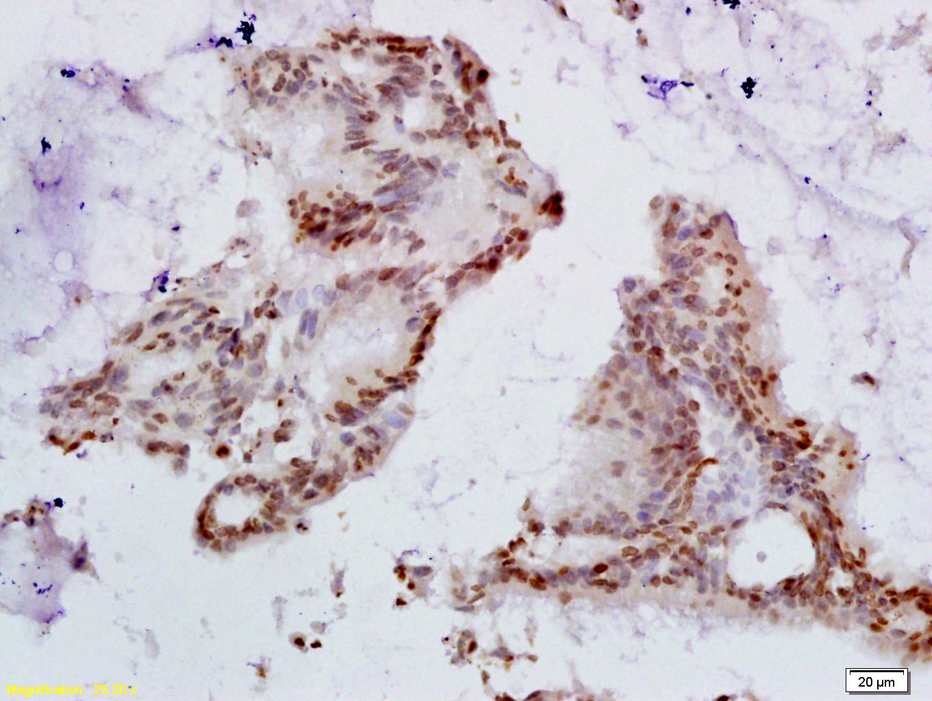 14 - HPV16 E6 + HPV18 E6 Rabbit pAb AP93982