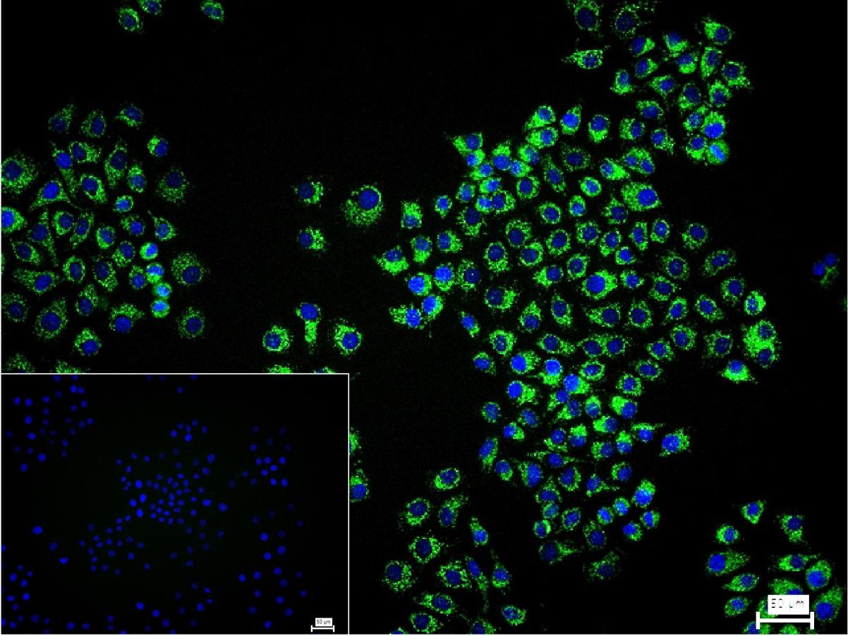 0 - VDAC1 Recombinant Rabbit mAb, Mitochondrial Loading Control AP93983