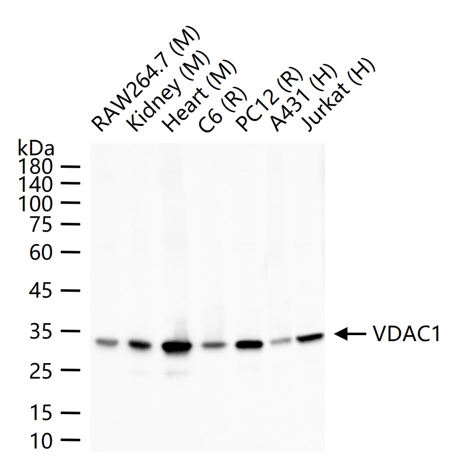 1 - VDAC1 Recombinant Rabbit mAb, Mitochondrial Loading Control AP93983