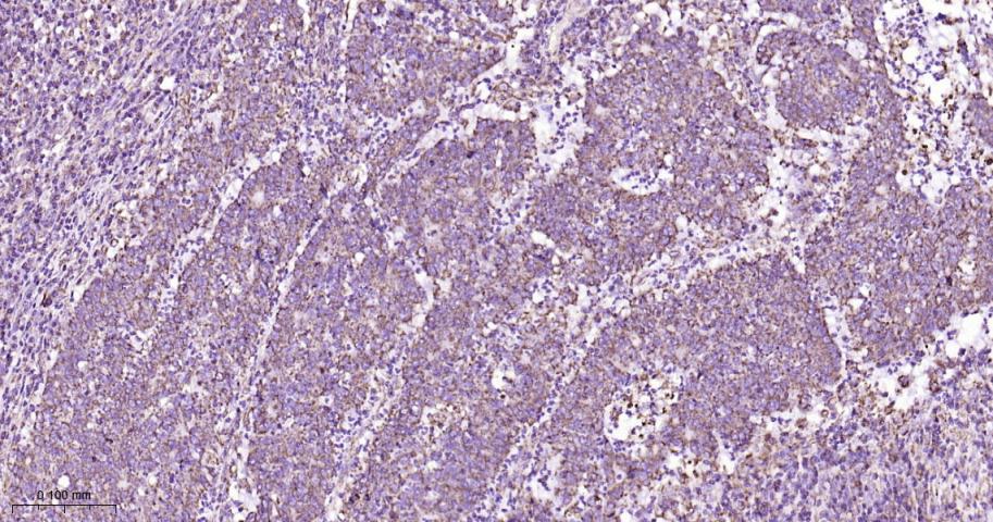 14 - VDAC1 Recombinant Rabbit mAb, Mitochondrial Loading Control AP93983
