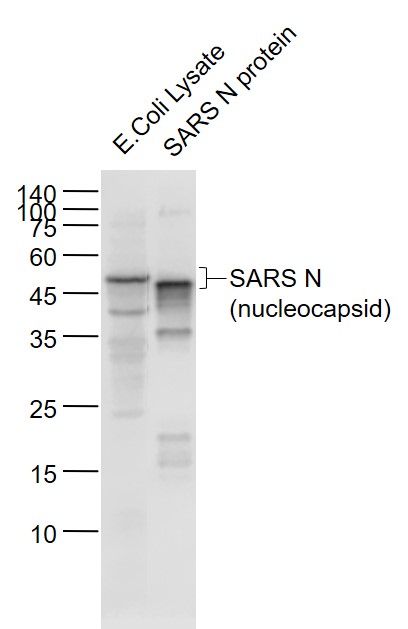 1 - SARS-CoV Nucleocapsid Mouse mAb AP93984