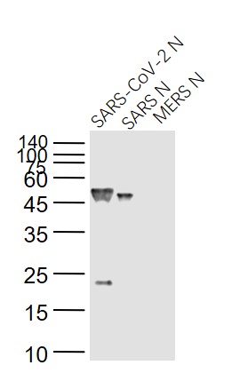 1 - SARS-CoV Nucleocapsid Mouse mAb AP93985