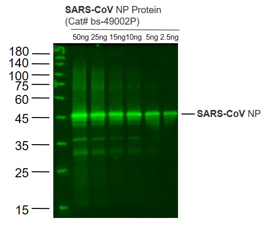 1 - SARS-CoV N Rabbit pAb AP93986